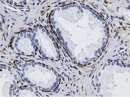 AK5 / Adenylate Kinase 5 Antibody - IHC of paraffin-embedded Human prostate tissue using anti-AK5 mouse monoclonal antibody.