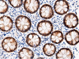 AK5 / Adenylate Kinase 5 Antibody - Immunohistochemical staining of paraffin-embedded Human colon tissue using anti-AK5 mouse monoclonal antibody.