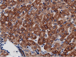AK5 / Adenylate Kinase 5 Antibody - Immunohistochemical staining of paraffin-embedded Human liver tissue using anti-AK5 mouse monoclonal antibody.