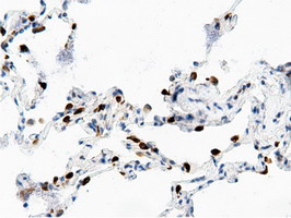 AK5 / Adenylate Kinase 5 Antibody - Immunohistochemical staining of paraffin-embedded Human lung tissue using anti-AK5 mouse monoclonal antibody.