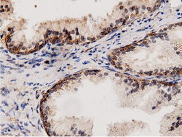 AK5 / Adenylate Kinase 5 Antibody - Immunohistochemical staining of paraffin-embedded Human prostate tissue using anti-AK5 mouse monoclonal antibody.
