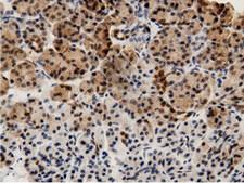 AK5 / Adenylate Kinase 5 Antibody - Immunohistochemical staining of paraffin-embedded Human pancreas tissue using anti-AK5 mouse monoclonal antibody.
