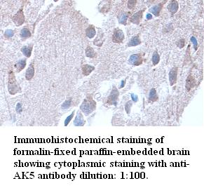 AK5 / Adenylate Kinase 5 Antibody