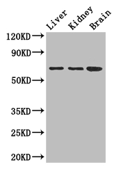 AK5 / Adenylate Kinase 5 Antibody - Positive WB detected in:Mouse liver tissue,Mouse kidney tissue,Mouse brain tissue;All lanes: AK5 antibody at 2.5ug/ml;Secondary;Goat polyclonal to rabbit IgG at 1/50000 dilution;Predicted band size: 64,22,61 kDa;Observed band size: 64 kDa;