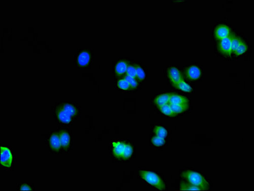 AK5 / Adenylate Kinase 5 Antibody - Immunofluorescent analysis of HepG2 cells using AK5 Antibody at a dilution of 1:100 and Alexa Fluor 488-congugated AffiniPure Goat Anti-Rabbit IgG(H+L)
