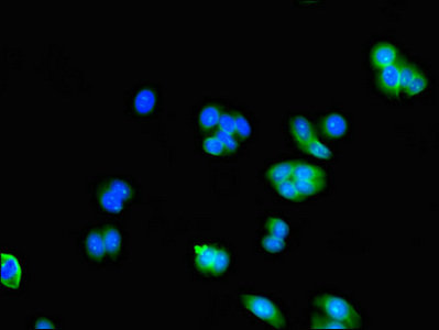 AK5 / Adenylate Kinase 5 Antibody - Immunofluorescent analysis of HepG2 cells using AK5 Antibody at dilution of 1:100 and Alexa Fluor 488-congugated AffiniPure Goat Anti-Rabbit IgG(H+L)