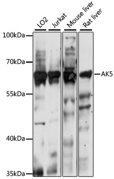 AK5 / Adenylate Kinase 5 Antibody - Western blot analysis of extracts of various cell lines, using AK5 antibody at 1:1000 dilution. The secondary antibody used was an HRP Goat Anti-Rabbit IgG (H+L) at 1:10000 dilution. Lysates were loaded 25ug per lane and 3% nonfat dry milk in TBST was used for blocking. An ECL Kit was used for detection and the exposure time was 10s.