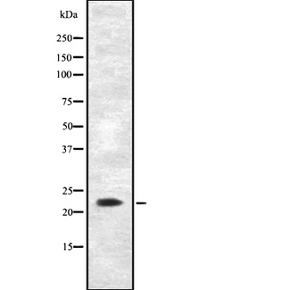AK5 / Adenylate Kinase 5 Antibody - Western blot analysis of AK5 using Jurkat whole cells lysates