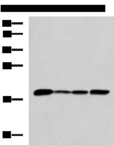 AK5 / Adenylate Kinase 5 Antibody - Western blot analysis of K562 Jurkat HepG2 cell Human fetal intestines tissue lysates  using AK6 Polyclonal Antibody at dilution of 1:800