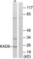 AK6 / Adenylate Kinase 6 Antibody - Western blot analysis of lysates from Jurkat cells, using KAD6 Antibody. The lane on the right is blocked with the synthesized peptide.