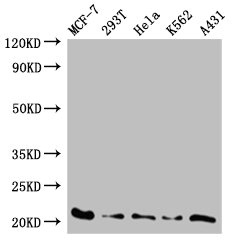 AK6 / Adenylate Kinase 6 Antibody - Western Blot Positive WB detected in:MCF-7 whole cell lysate,293T whole cell lysate,Hela whole cell lysate,K562 whole cell lysate,A431 whole cell lysate All Lanes: AK6 antibody at 0.59 ug/ml Secondary Goat polyclonal to rabbit IgG at 1/50000 dilution Predicted band size: 21,20kDa Observed band size: 20 kDa
