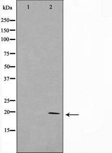 AK6 / Adenylate Kinase 6 Antibody - Western blot analysis on HepG2 cell lysates using KAD6 antibody. The lane on the left is treated with the antigen-specific peptide.