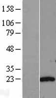 AK6 / Adenylate Kinase 6 Protein - Western validation with an anti-DDK antibody * L: Control HEK293 lysate R: Over-expression lysate