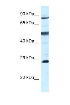 AK7 / Adenylate Kinase 7 Antibody - AK7 antibody Western blot of MCF7 Cell lysate. Antibody concentration 1 ug/ml.  This image was taken for the unconjugated form of this product. Other forms have not been tested.