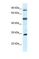 AK7 / Adenylate Kinase 7 Antibody - AK7 antibody Western blot of MCF7 Cell lysate. Antibody concentration 1 ug/ml.  This image was taken for the unconjugated form of this product. Other forms have not been tested.