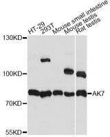AK7 / Adenylate Kinase 7 Antibody - Western blot analysis of extracts of various cell lines, using AK7 antibody at 1:1000 dilution. The secondary antibody used was an HRP Goat Anti-Rabbit IgG (H+L) at 1:10000 dilution. Lysates were loaded 25ug per lane and 3% nonfat dry milk in TBST was used for blocking. An ECL Kit was used for detection and the exposure time was 3s.