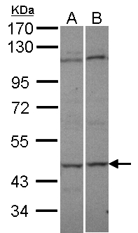 AK8 Antibody - Sample (30 ug of whole cell lysate). A: A431, B: HeLa S3. 7.5% SDS PAGE. C9orf98 antibody diluted at 1:500