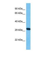AK8 Antibody - Western blot of Human Thyroid tumor. AK8 antibody dilution 1.0 ug/ml.  This image was taken for the unconjugated form of this product. Other forms have not been tested.