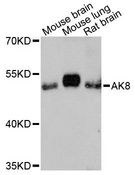 AK8 Antibody - Western blot analysis of extracts of various cell lines, using AK8 antibody at 1:3000 dilution. The secondary antibody used was an HRP Goat Anti-Rabbit IgG (H+L) at 1:10000 dilution. Lysates were loaded 25ug per lane and 3% nonfat dry milk in TBST was used for blocking. An ECL Kit was used for detection and the exposure time was 90s.