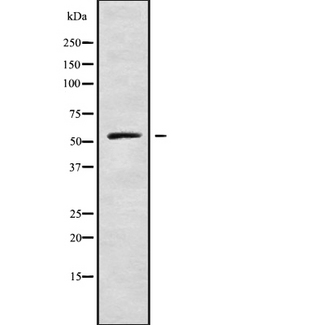 AK8 Antibody - Western blot analysis of CI098 using HepG2 whole cells lysates