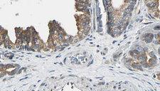 AK8 Antibody - 1:100 staining human prostate tissue by IHC-P. The sample was formaldehyde fixed and a heat mediated antigen retrieval step in citrate buffer was performed. The sample was then blocked and incubated with the antibody for 1.5 hours at 22°C. An HRP conjugated goat anti-rabbit antibody was used as the secondary.