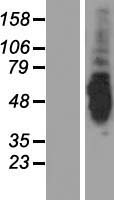 AK8 Protein - Western validation with an anti-DDK antibody * L: Control HEK293 lysate R: Over-expression lysate