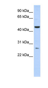 AK9 / AKD1 / AKD2 Antibody - AKD1 / C6orf199 antibody Western blot of Fetal Liver lysate. This image was taken for the unconjugated form of this product. Other forms have not been tested.