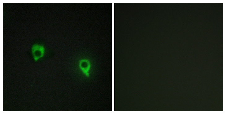 AKAP1 / AKAP Antibody - Immunofluorescence analysis of COS7 cells, using AKAP1 Antibody. The picture on the right is blocked with the synthesized peptide.