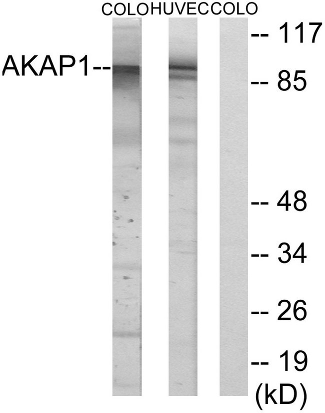 AKAP1 / AKAP Antibody - Western blot analysis of lysates from HUVEC and COLO cells, using AKAP1 Antibody. The lane on the right is blocked with the synthesized peptide.