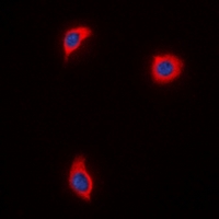 AKAP1 / AKAP Antibody - Immunofluorescent analysis of AKAP1 staining in HUVEC cells. Formalin-fixed cells were permeabilized with 0.1% Triton X-100 in TBS for 5-10 minutes and blocked with 3% BSA-PBS for 30 minutes at room temperature. Cells were probed with the primary antibody in 3% BSA-PBS and incubated overnight at 4 deg C in a humidified chamber. Cells were washed with PBST and incubated with a DyLight 594-conjugated secondary antibody (red) in PBS at room temperature in the dark. DAPI was used to stain the cell nuclei (blue).