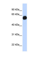 AKAP1 / AKAP Antibody - AKAP1 antibody Western blot of Fetal Brain lysate. This image was taken for the unconjugated form of this product. Other forms have not been tested.