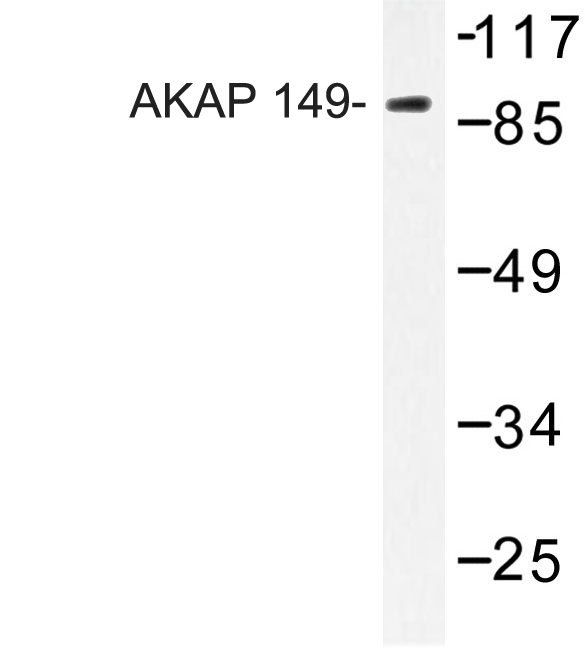 AKAP1 / AKAP Antibody - Western blot of AKAP 149(N306) pAb in extracts from HUVEC cells.