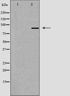 AKAP1 / AKAP Antibody - Western blot analysis of extracts of HuvEc cells using AKAP1 antibody. The lane on the left is treated with the antigen-specific peptide.