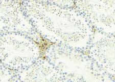 AKAP1 / AKAP Antibody - 1:100 staining mouse testis tissue by IHC-P. The sample was formaldehyde fixed and a heat mediated antigen retrieval step in citrate buffer was performed. The sample was then blocked and incubated with the antibody for 1.5 hours at 22°C. An HRP conjugated goat anti-rabbit antibody was used as the secondary.