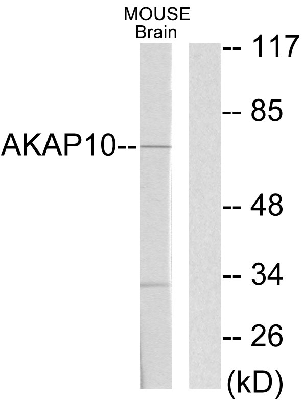 AKAP10 Antibody - Western blot analysis of lysates from mouse brain, using AKAP10 Antibody. The lane on the right is blocked with the synthesized peptide.