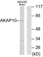 AKAP10 Antibody - Western blot analysis of lysates from mouse brain, using AKAP10 Antibody. The lane on the right is blocked with the synthesized peptide.