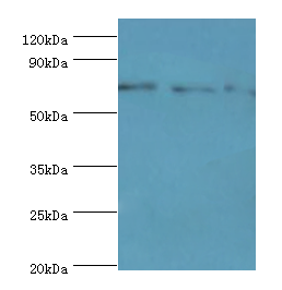 AKAP10 Antibody - Western blot. All lanes: AKAP10 antibody at 7 ug/ml. Lane 1: 293T whole cell lysate. Lane 2: HeLa whole cell lysate. Lane 3: HepG2 whole cell lysate. secondary Goat polyclonal to rabbit at 1:10000 dilution. Predicted band size: 74 kDa. Observed band size: 74 kDa.