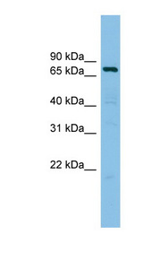 AKAP10 Antibody - AKAP10 antibody Western blot of RPMI-8226 cell lysate. This image was taken for the unconjugated form of this product. Other forms have not been tested.