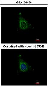 AKAP10 Antibody - Immunofluorescence of methanol-fixed HeLa using AKAP10 antibody at 1:500 dilution.