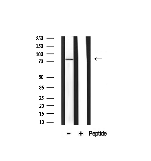 AKAP10 Antibody - Western blot analysis on mouse muscle lysate using AKAP10 antibody