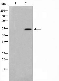 AKAP10 Antibody - Western blot analysis on mouse brain cell lysates using AKAP10 antibody. The lane on the left is treated with the antigen-specific peptide.