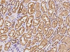 AKAP10 Antibody - Immunochemical staining of human AKAP10 in human kidney with rabbit polyclonal antibody at 1:100 dilution, formalin-fixed paraffin embedded sections.