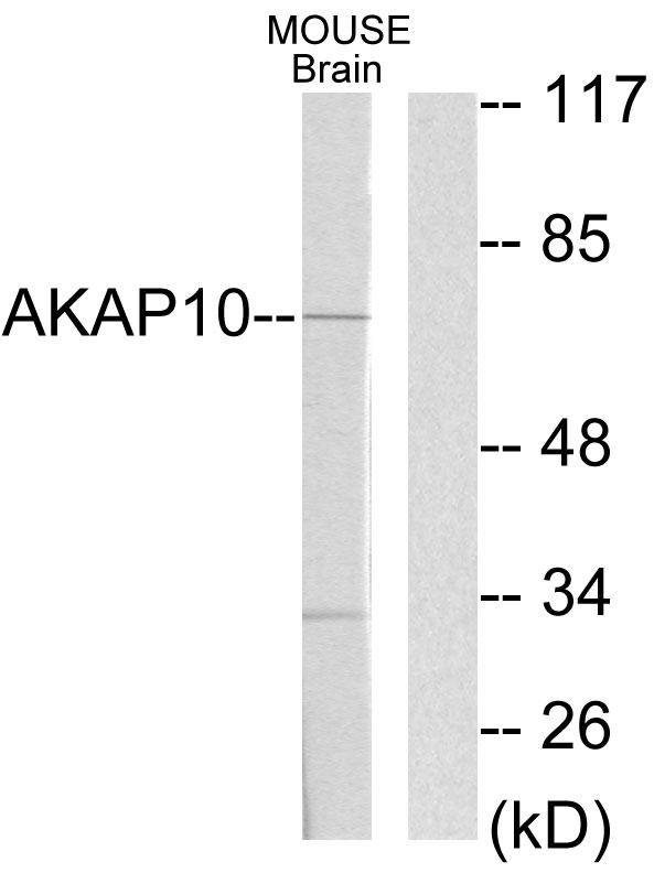 AKAP10 Antibody - Western blot analysis of extracts from mouse brain cells, using AKAP10 antibody.