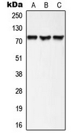 AKAP10 Antibody - Western blot analysis of AKAP10 expression in HepG2 (A); mouse heart (B); rat heart (C) whole cell lysates.