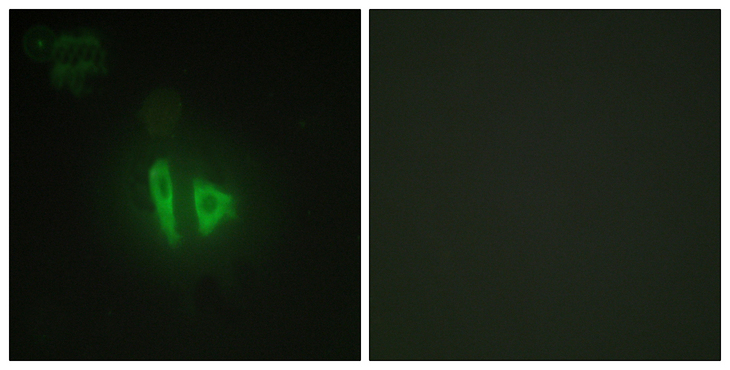 AKAP11 / KIAA0629 Antibody - Immunofluorescence analysis of HepG2 cells, using AKAP11 Antibody. The picture on the right is blocked with the synthesized peptide.