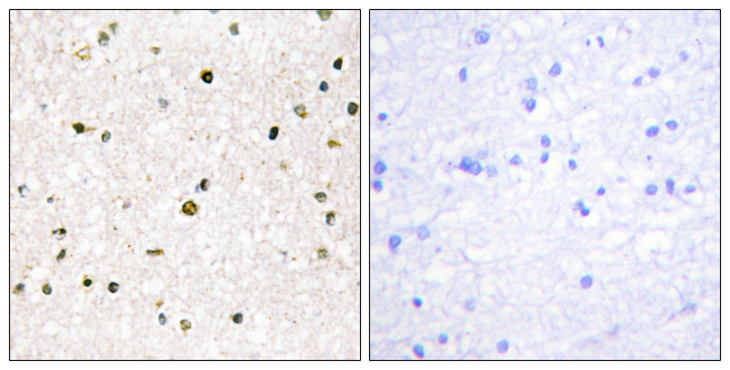 AKAP11 / KIAA0629 Antibody - Immunohistochemistry analysis of paraffin-embedded human brain tissue, using AKAP11 Antibody. The picture on the right is blocked with the synthesized peptide.