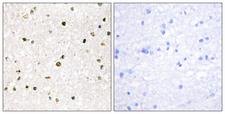 AKAP11 / KIAA0629 Antibody - Immunohistochemistry analysis of paraffin-embedded human brain tissue, using AKAP11 Antibody. The picture on the right is blocked with the synthesized peptide.