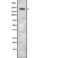 AKAP11 / KIAA0629 Antibody - Western blot analysis of AKAP11 using K562 whole cells lysates