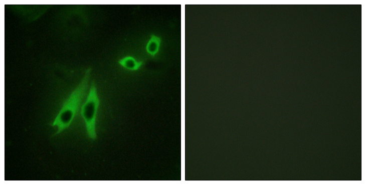 AKAP110 / AKAP3 Antibody - Immunofluorescence analysis of NIH/3T3 cells, using AKAP3 Antibody. The picture on the right is blocked with the synthesized peptide.