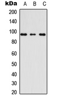 AKAP110 / AKAP3 Antibody - Western blot analysis of AKAP3 expression in Raw264.7 (A); HeLa (B); H9C2 (C) whole cell lysates.